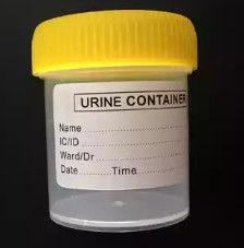Spritzen-Urin-Kollektor-Form Soem CAD/ug kundenspezifisches medizinisches